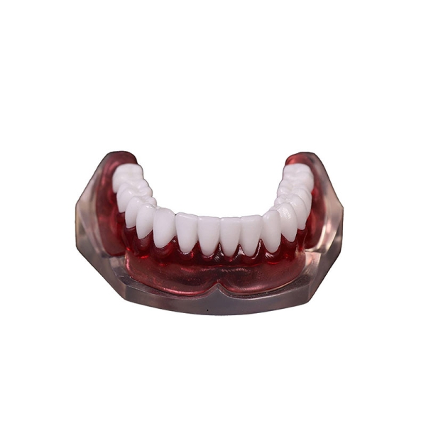 树脂3D打印牙模